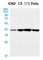PRKACA Recombinant Rabbit Monoclonal Antibody