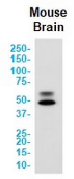 CAMK2B Recombinant Rabbit Monoclonal Antibody