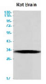 CALB2 Antibody in Western Blot (WB)
