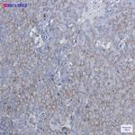 BTF3 Recombinant Rabbit Monoclonal Antibody