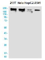 Smarca4 Recombinant Rabbit Monoclonal Antibody