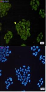 BRAT1 Recombinant Rabbit Monoclonal Antibody