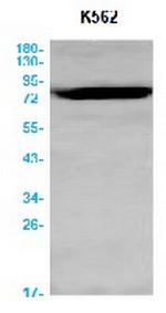 BRAT1 Antibody in Western Blot (WB)