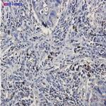 BNIP3L Recombinant Rabbit Monoclonal Antibody