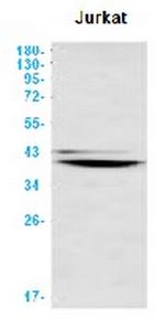 BNIP3L Antibody in Western Blot (WB)