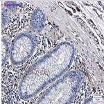 TUBB3 Recombinant Rabbit Monoclonal Antibody