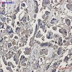 TUBB3 Recombinant Rabbit Monoclonal Antibody