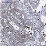 BCL2L1 Recombinant Rabbit Monoclonal Antibody