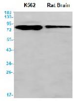 BAG3 Recombinant Rabbit Monoclonal Antibody