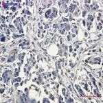 BAG1 Recombinant Rabbit Monoclonal Antibody