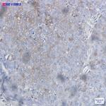 BAD Antibody in Immunohistochemistry (Paraffin) (IHC (P))