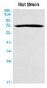 BACE1 Recombinant Rabbit Monoclonal Antibody