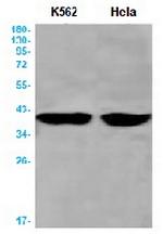 AURKB Recombinant Rabbit Monoclonal Antibody