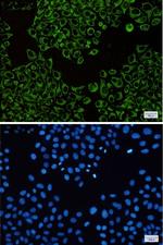 ATP5F1B Recombinant Rabbit Monoclonal Antibody