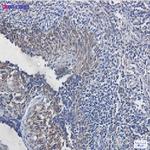 ATP5F1B Antibody in Immunohistochemistry (Paraffin) (IHC (P))