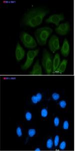 ACLY Recombinant Rabbit Monoclonal Antibody