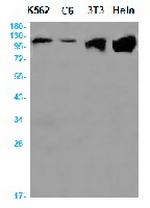 ACLY Antibody in Western Blot (WB)