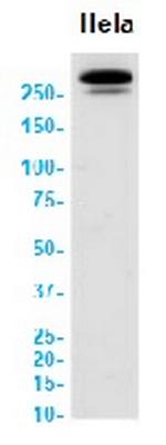 ATM Recombinant Rabbit Monoclonal Antibody