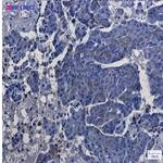 ASS1 Recombinant Rabbit Monoclonal Antibody