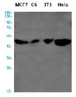 CYP19A1 Recombinant Rabbit Monoclonal Antibody