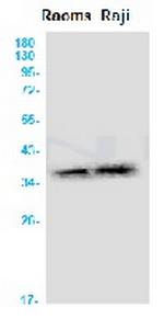 AQP2 Recombinant Rabbit Monoclonal Antibody