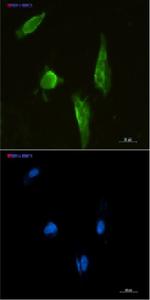 APTX Recombinant Rabbit Monoclonal Antibody