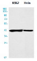 APTX Antibody in Western Blot (WB)