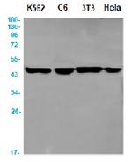 AP3M1 Recombinant Rabbit Monoclonal Antibody