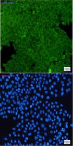 ANXA2 Recombinant Rabbit Monoclonal Antibody