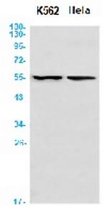ANGPTL4 Recombinant Rabbit Monoclonal Antibody