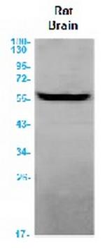 ANGPT2 Recombinant Rabbit Monoclonal Antibody