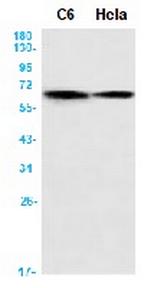 PRKAA2 Recombinant Rabbit Monoclonal Antibody