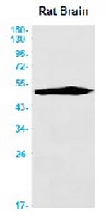 TUBA4A Recombinant Rabbit Monoclonal Antibody