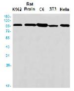 ACTN4 Recombinant Rabbit Monoclonal Antibody
