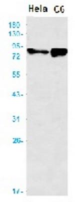 ALPL Recombinant Rabbit Monoclonal Antibody