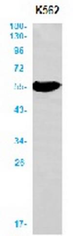 ALDH2 Recombinant Rabbit Monoclonal Antibody