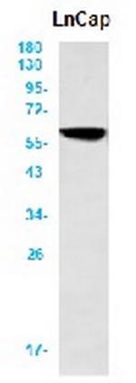 AKT3 Recombinant Rabbit Monoclonal Antibody