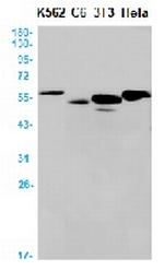 PNPLA2 Antibody in Western Blot (WB)