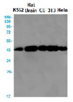 ACTA1 Antibody in Western Blot (WB)