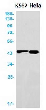 ACAT1 Recombinant Rabbit Monoclonal Antibody