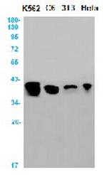 RPSA Recombinant Rabbit Monoclonal Antibody