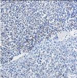 VCAM1 Recombinant Rabbit Monoclonal Antibody