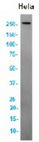 ATM Recombinant Rabbit Monoclonal Antibody