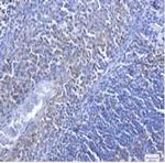 CASP3 Antibody in Immunohistochemistry (Paraffin) (IHC (P))
