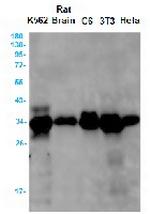 CASP3 Antibody in Western Blot (WB)
