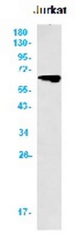 PRKAA2 Recombinant Rabbit Monoclonal Antibody