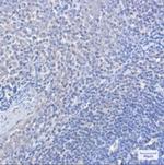 FOXO1 Antibody in Immunohistochemistry (Paraffin) (IHC (P))