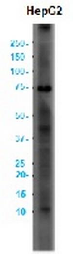 FOXO1 Antibody in Western Blot (WB)