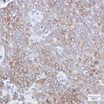 BCL2 Antibody in Immunohistochemistry (Paraffin) (IHC (P))