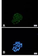 BNIP3 Recombinant Rabbit Monoclonal Antibody